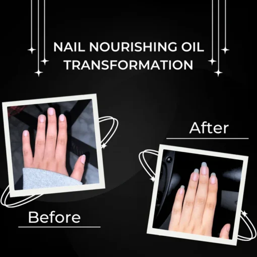 Nail Nourishing oil - Image 3